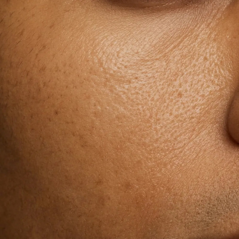 <p><strong>Peau mixte</strong></p>